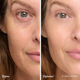ReFresh Eye Brightener SPF 30 | Correcting Tint